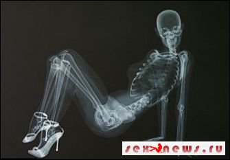 Модели разделись догола перед рентгеном Модели разделись догола перед рентгеном